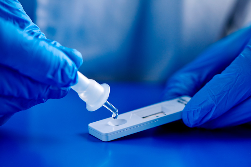 Rapid Antigen Test Rapid Antigen Test