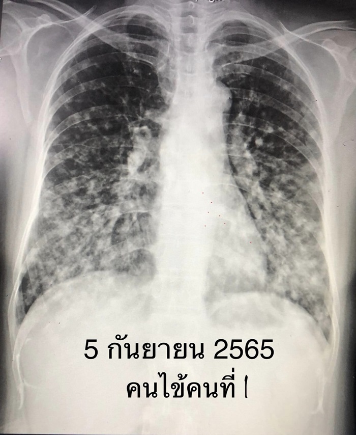 เชื้อรามูลค้างคาว เชื้อรามูลค้างคาว