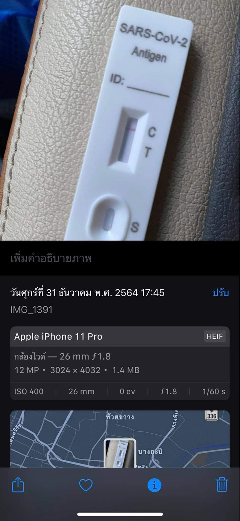 ตรวจ atk ตรวจ atk