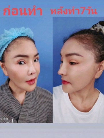 ดาว มยุรีย์ ดาว มยุรีย์