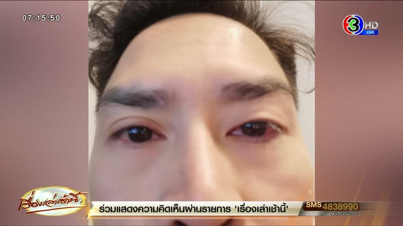 โควิดสายพันธุ์ใหม่ XBB.1.16 โควิดสายพันธุ์ใหม่ XBB.1.16