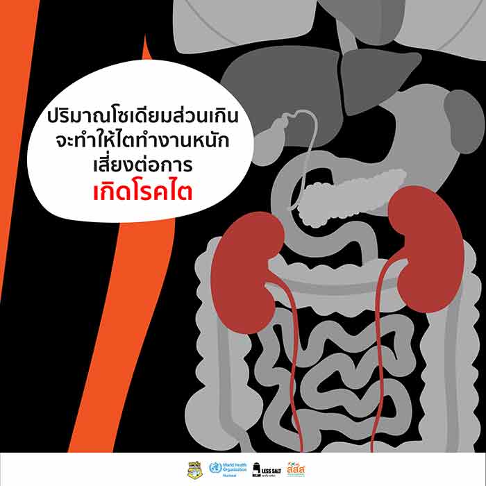 อาหารโซเดียมสูง อาหารโซเดียมสูง