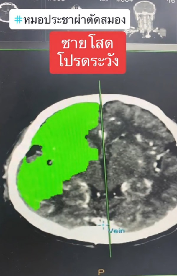 หมอเตือน หมอเตือน