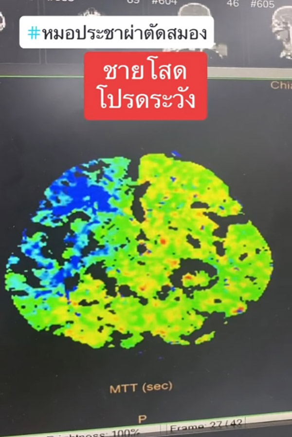 หมอเตือน หมอเตือน