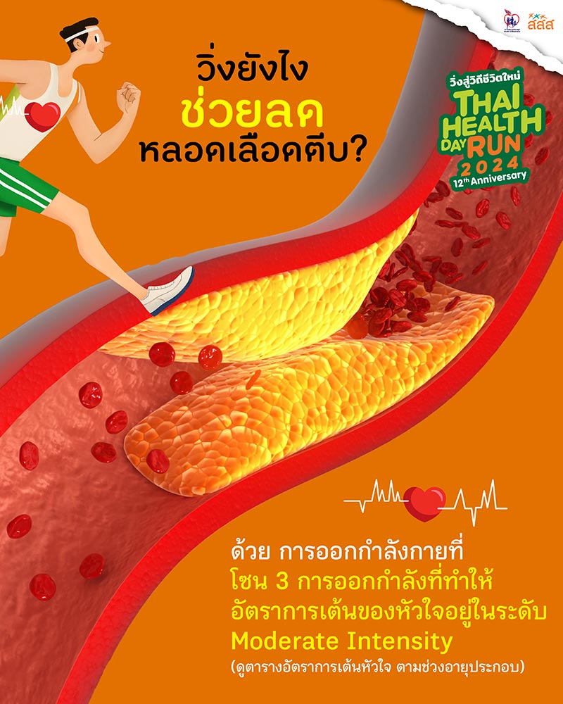 วิ่งโซน 3 เส้นเลือดหัวใจตีบฟื้นฟูได้ด้วยการวิ่งโซน 3