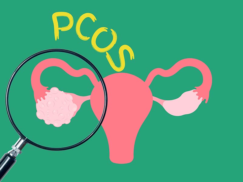 pcos pcos