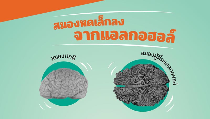 สมองหดเล็กเพราะดื่มแอลกอฮอล์ สมองหดตัว