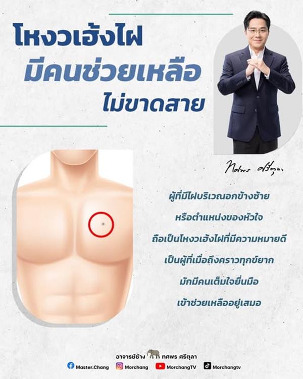 หมอช้าง ทศพร หมอช้าง ทศพร