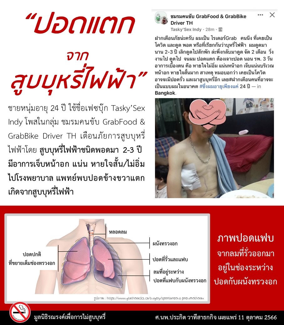 บุหรี่ไฟฟ้าอันตราย ปอดแตก ปอดรั่ว