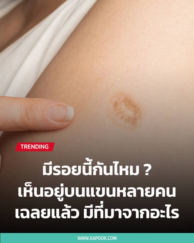 ปลูกฝี ปลูกฝี