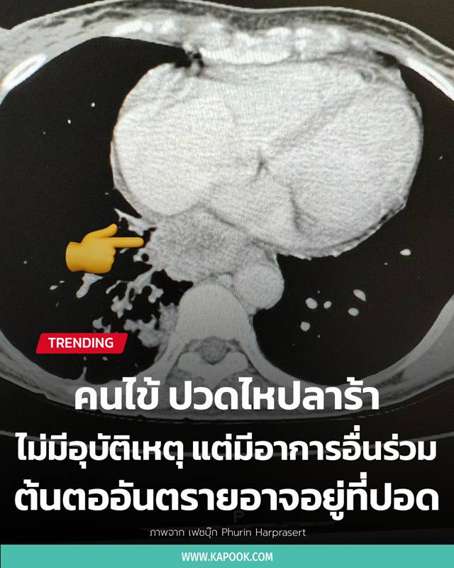 ปวดกระดูก ปวดกระดูก