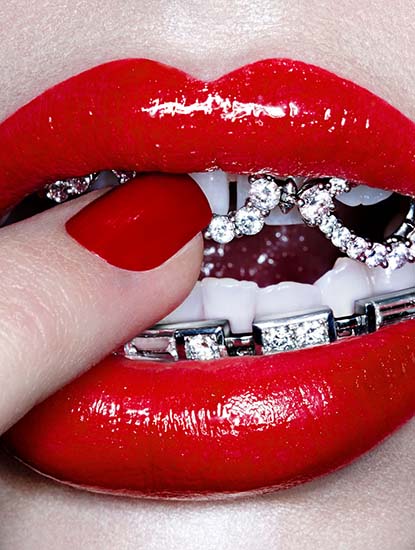 ฟันเลี่ยมเพชร ฟันเลี่ยมเพชร