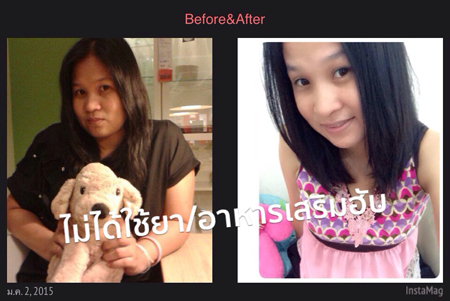 ลดน้ำหนัก ลดน้ำหนัก