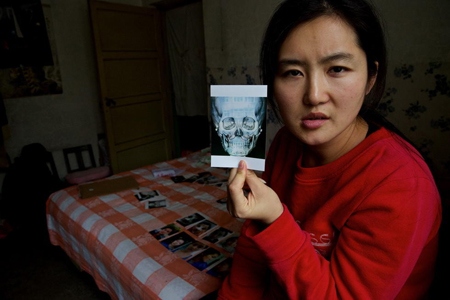 ศัลยกรรม ศัลยกรรม