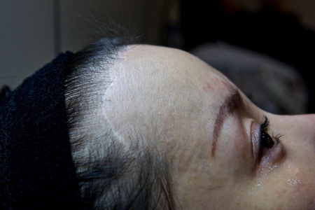 ศัลยกรรม ศัลยกรรม