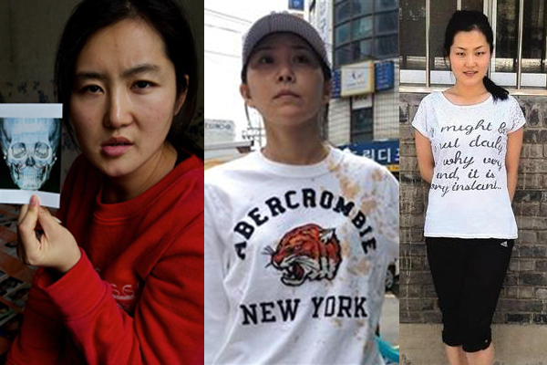 ศัลยกรรม ศัลยกรรม