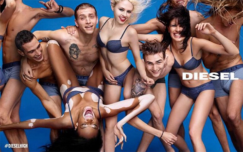 นางแบบผิวด่างขาว นางแบบผิวด่างขาว