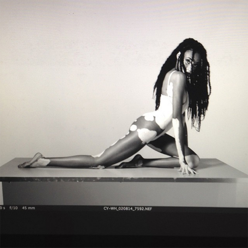 นางแบบผิวด่างขาว นางแบบผิวด่างขาว