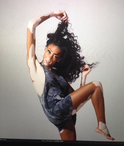 นางแบบผิวด่างขาว นางแบบผิวด่างขาว