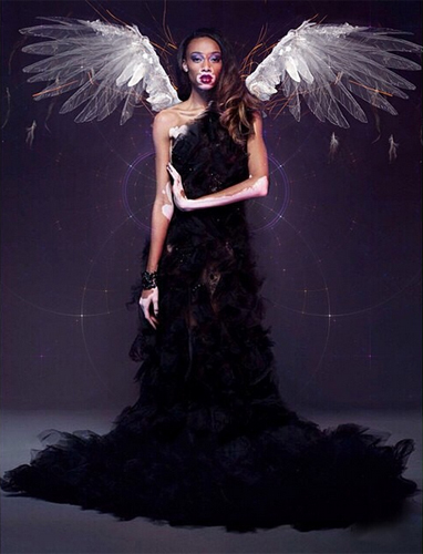 นางแบบผิวด่างขาว นางแบบผิวด่างขาว