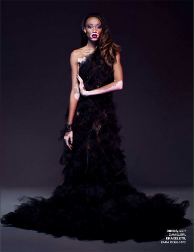 นางแบบผิวด่างขาว นางแบบผิวด่างขาว