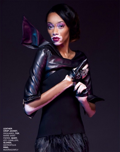 นางแบบผิวด่างขาว นางแบบผิวด่างขาว