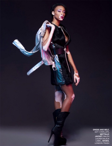 นางแบบผิวด่างขาว นางแบบผิวด่างขาว