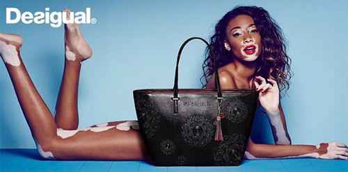 นางแบบผิวด่างขาว นางแบบผิวด่างขาว