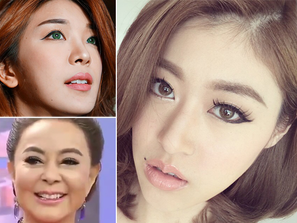 ดาราศัลยกรรมปาก ดาราศัลยกรรมปาก