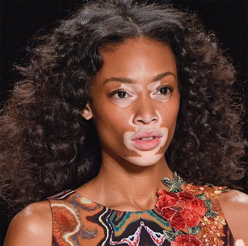 แชนเทล บราวน์ ยัง แชนเทล บราวน์ ยัง