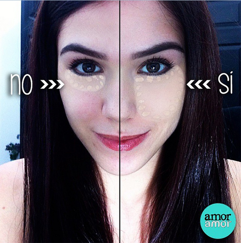 ถุงใต้ตา ถุงใต้ตา