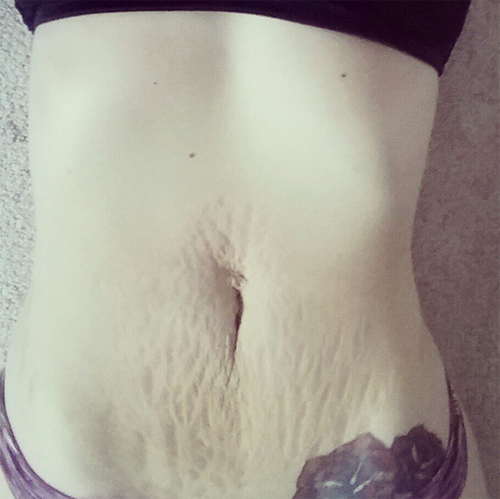 loveyourlines loveyourlines