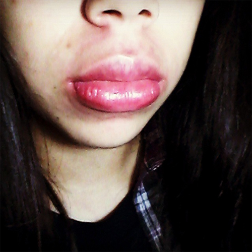 ทำปากอวบอิ่ม, ทำปากอวบอิ่ม,