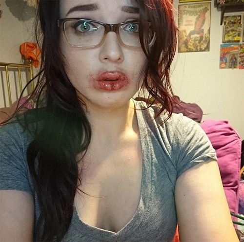 ทำปากอวบอิ่ม, ทำปากอวบอิ่ม,