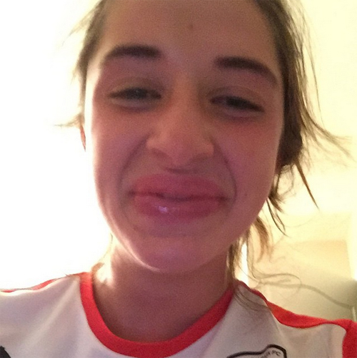 ทำปากอวบอิ่ม, ทำปากอวบอิ่ม,