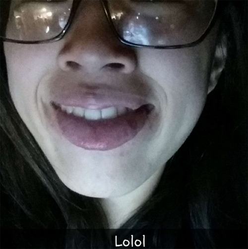 ทำปากอวบอิ่ม ทำปากอวบอิ่ม