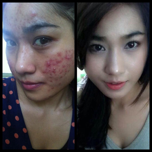 สาวลดน้ำหนัก สาวลดน้ำหนัก