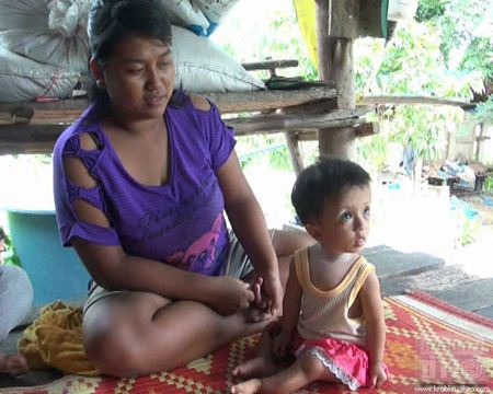 วอนช่วยหนูน้อย 1 ขวบ ป่วยกระดูกกรอบ-ขาหัก 7 ครั้ง
