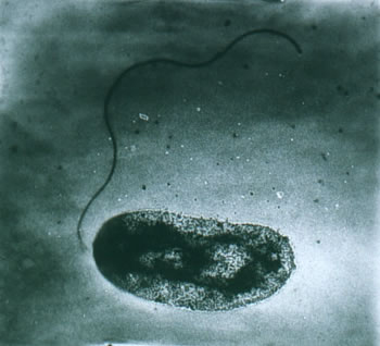 เชื้อไวบริโอ วัลนิฟิคัส (Vibrio vulnificus) เชื้อไวบริโอ วัลนิฟิคัส (Vibrio vulnificus)