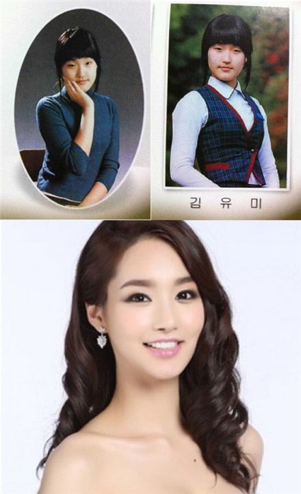 ชาวเน็ตเกาหลีแฉภาพก่อนหลังศัลยกรรม คิมยูมิ มิสเกาหลี 2012