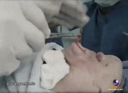 แย้ นนทพร