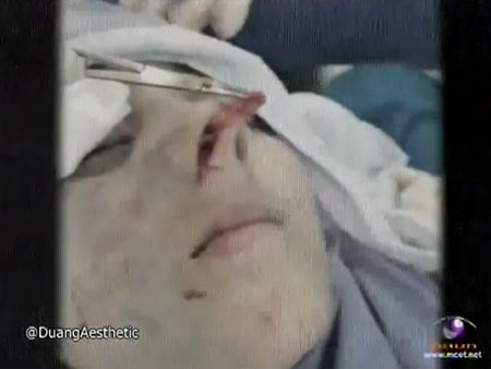 แย้ นนทพร