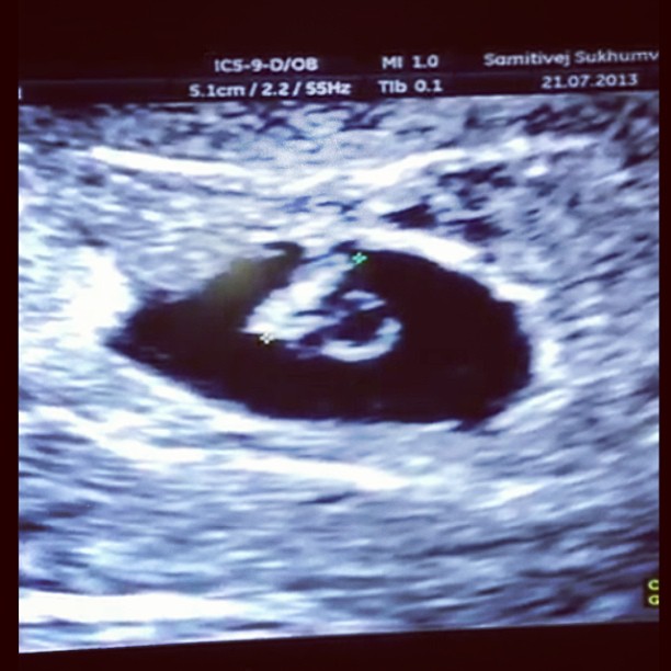 ไก่ มีสุข ท้อง ไก่ มีสุข ท้อง