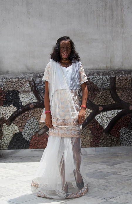 อินเดียถ่ายแฟชั่นหญิงถูกสาดน้ำกรด อินเดียถ่ายแฟชั่นหญิงถูกสาดน้ำกรด