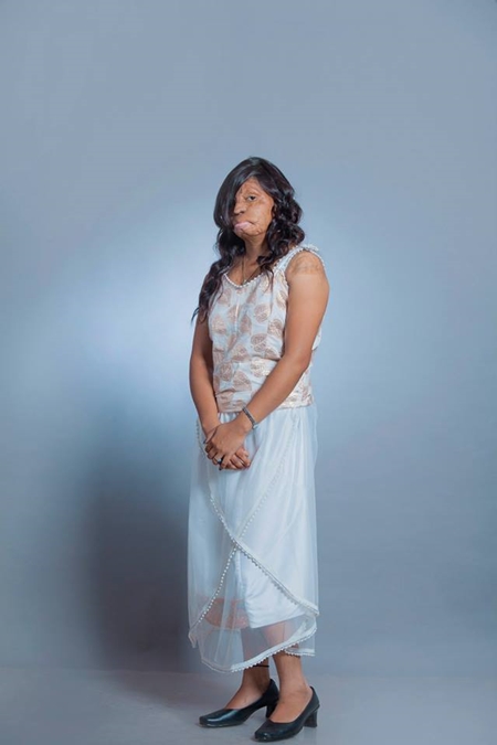 อินเดียถ่ายแฟชั่นหญิงถูกสาดน้ำกรด อินเดียถ่ายแฟชั่นหญิงถูกสาดน้ำกรด