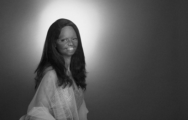 อินเดียถ่ายแฟชั่นหญิงถูกสาดน้ำกรด อินเดียถ่ายแฟชั่นหญิงถูกสาดน้ำกรด