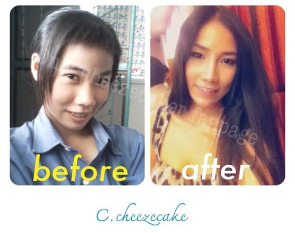 ชีสเค้ก จริยา พริตตี้ศัลยกรรม ชีสเค้ก จริยา พริตตี้ศัลยกรรม