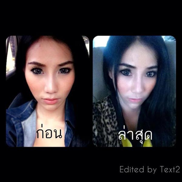 ชีสเค้ก จริยา พริตตี้ศัลยกรรม ชีสเค้ก จริยา พริตตี้ศัลยกรรม