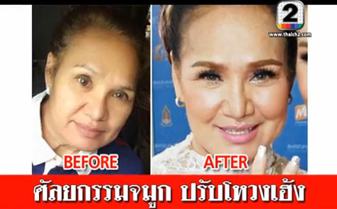 น้อย โพธิ์งาม น้อย โพธิ์งาม