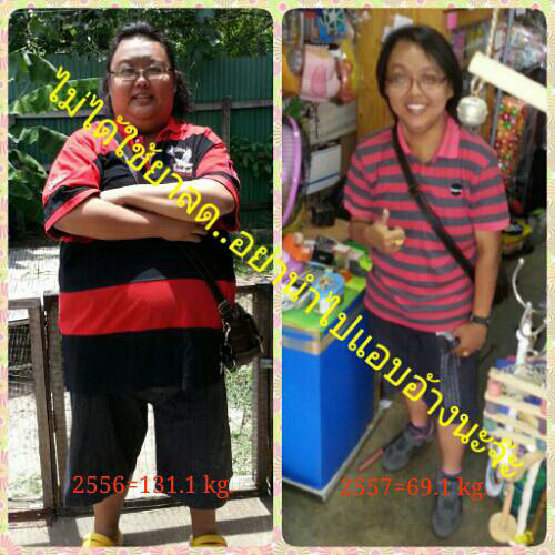 แชร์วิธีลดน้ำหนัก แชร์วิธีลดน้ำหนัก